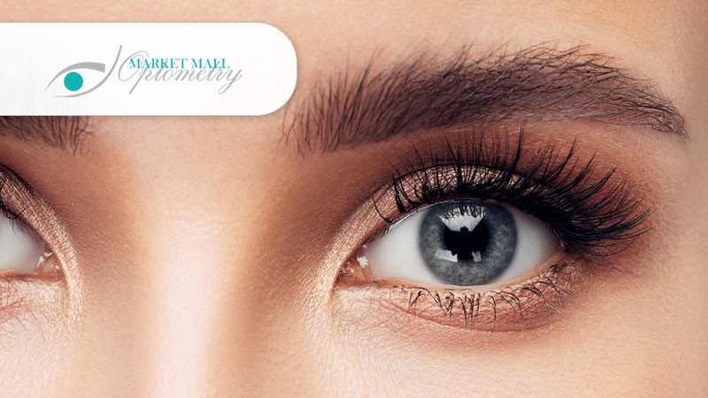Market Mall Optometry | Laser Eye Surgery NW
