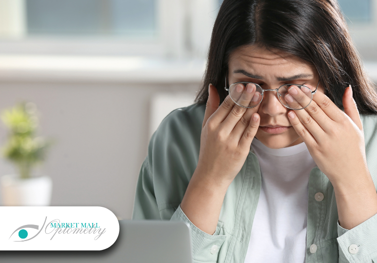 What to Do in an Eye Emergency: Calgary’s Expert Advice 