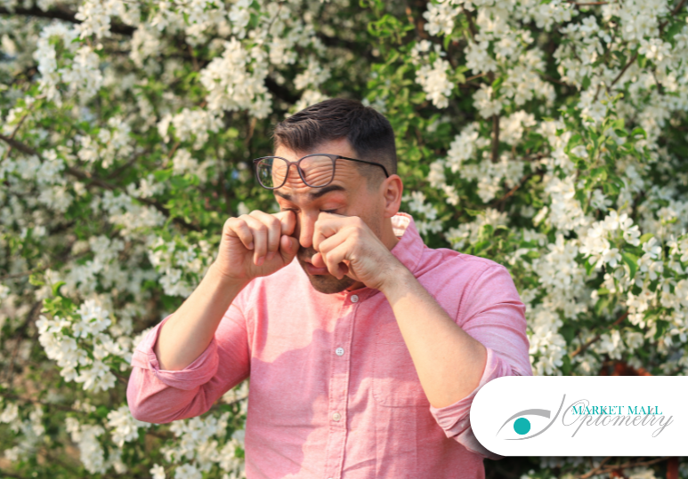 Managing Allergies and Eye Irritation: Tips for Calgary Residents 