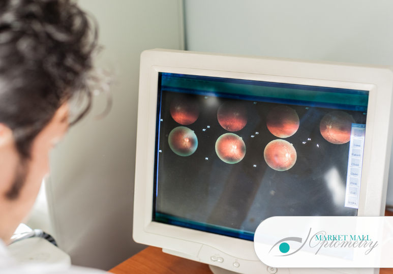 Why Retinal Imaging Is Essential for Preventive Eye Care in Calgary 