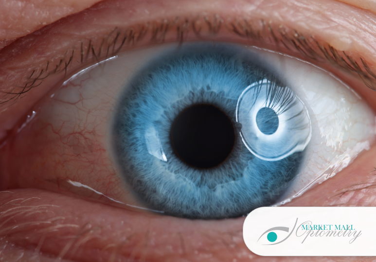 Why Retinal Imaging Is Essential for Preventive Eye Care in Calgary 
