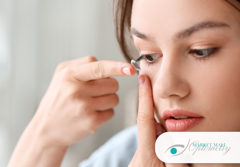 Contact Lens Fit Matters: Comfort, Vision, and Eye Health 