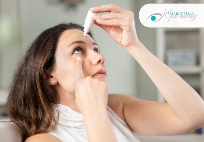 Is Dry Eye Treatable at Home? 