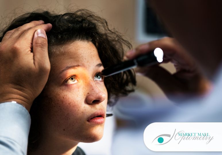 EARLY SIGNS OF EYE PROBLEMS AN OPTOMETRIST CAN DETECT – CALGARY OPTOMETRISTS