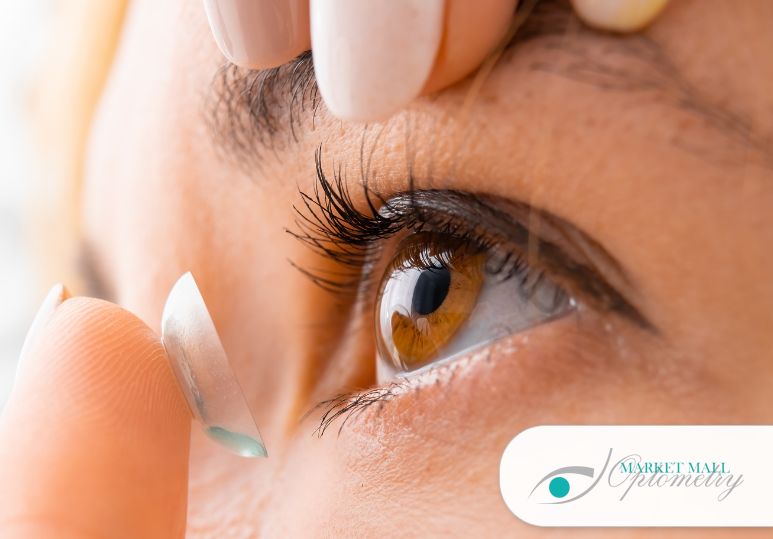 Specialty Contact Lenses for Astigmatism and Complex Vision Needs – Contact Lenses Calgary